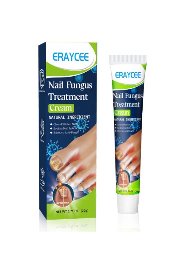 ERAYCEE Nail Fungus Treatment Cream, 20g Toenail Fungus Treatment Cream - Image 5